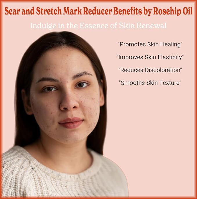 SALE! 4oz Rosehip Seed Oil, 100% Pure and Natural, Cold-Pressed, Unrefined, Organic Moisturizer for