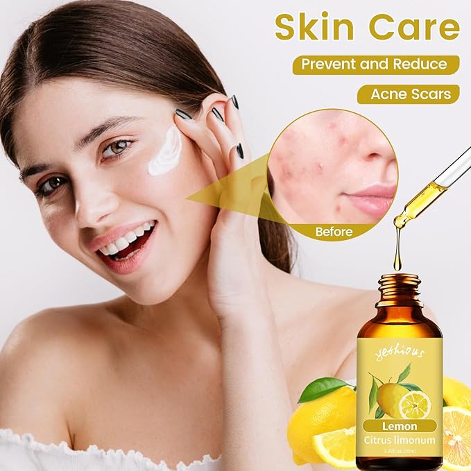 yethious Lemon Essential Oil Lemon Essential Oill for Diffuser, Perfume, Body, Skin, Hair, Candle