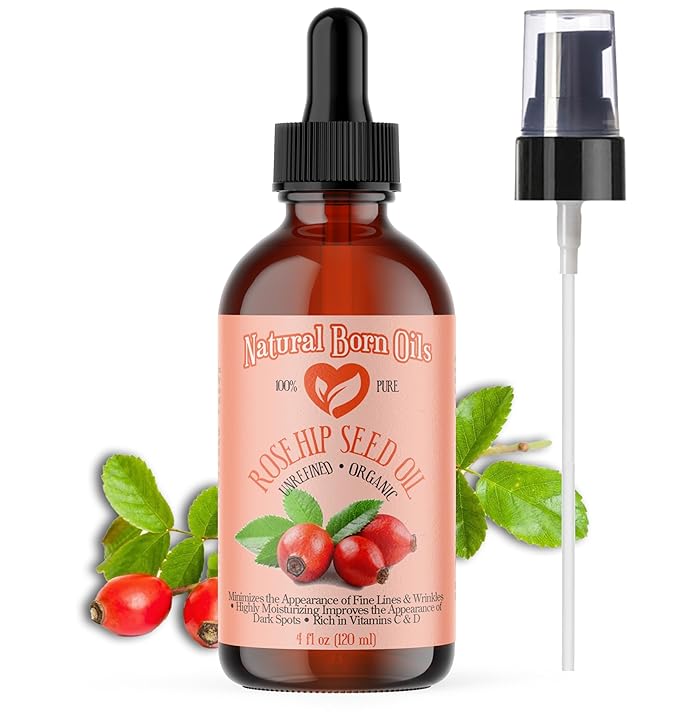 SALE! 4oz Rosehip Seed Oil, 100% Pure and Natural, Cold-Pressed, Unrefined, Organic Moisturizer for